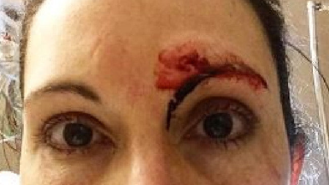 US jogger Kelly Herron has explained how she fought her way out of a bathroom attack